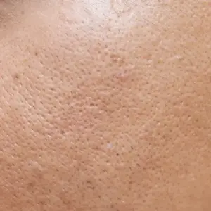 Poras