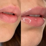 pirkti DR. HEDISON Melting Lip Oil kaina